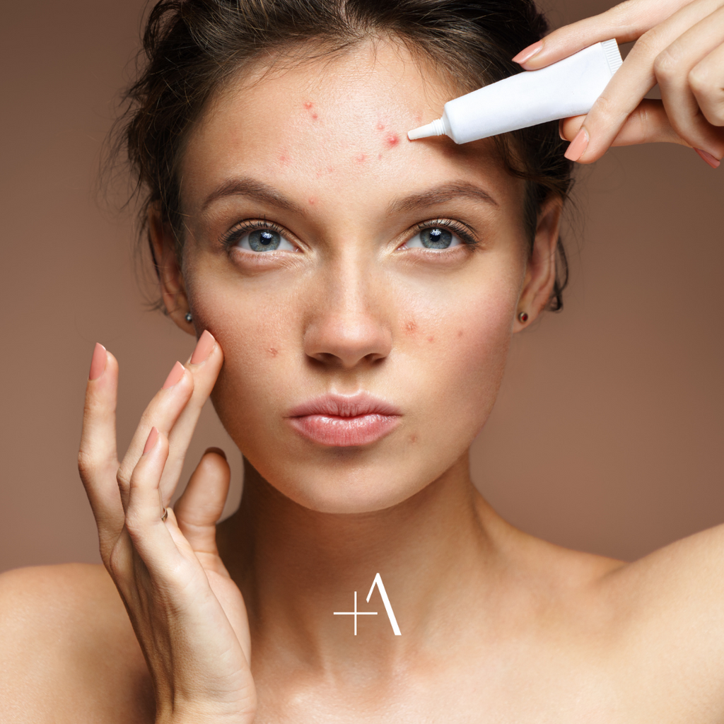 Acne; FACT vs FICTION